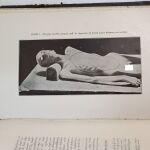 Ο Παρθενικός υμήν, ο Μηχανισμός της Ανοσίας, αι κατά τας Δηλητηριάσεις Ιατροδικαστικαί Φροντίδες 1910